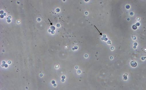 酵母双杂交手艺原理、、试验流程、、特点以及应用
