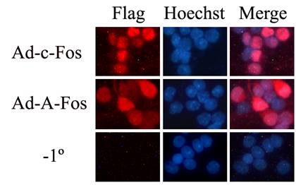 腺病毒熏染原代神经元