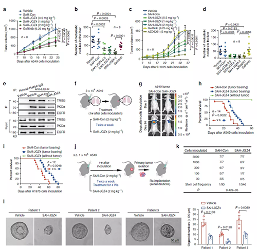 靶向EGFR稳固性抑制肺癌的爆发和开展