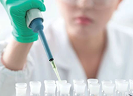 Science子刊：：一种新模子可预测微粒制剂的可注射性