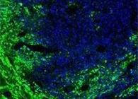 联协实力！！溶瘤病毒与CAR-T翻开攻克实体瘤难题的新思绪