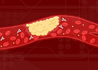 【Science速递】攻克COVID-19里程碑：已确定血凝块形成原因！！