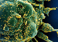 唾液检测新冠抗体新要领来了，，获取效果仅需几小时！！