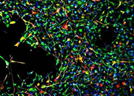 天下首创：药物将干细胞指导至受损部位，，提高其愈合能力！！