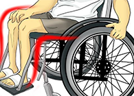 Nature：：还瘫痪患者一个自由身的日子不远了