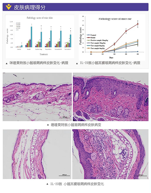 咪喹莫特致小鼠银屑病样皮肤转变病理得分