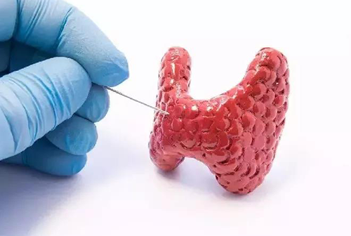 甲状腺疾病，，，包括甲状腺功效减退和甲状腺功效亢进，，，自古以来就是重复被医学研究职员研究的疾病