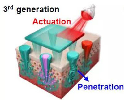 第三代：通过微针介导的皮肤层破损和微针陪同的种种功效增强药物转运.jpg