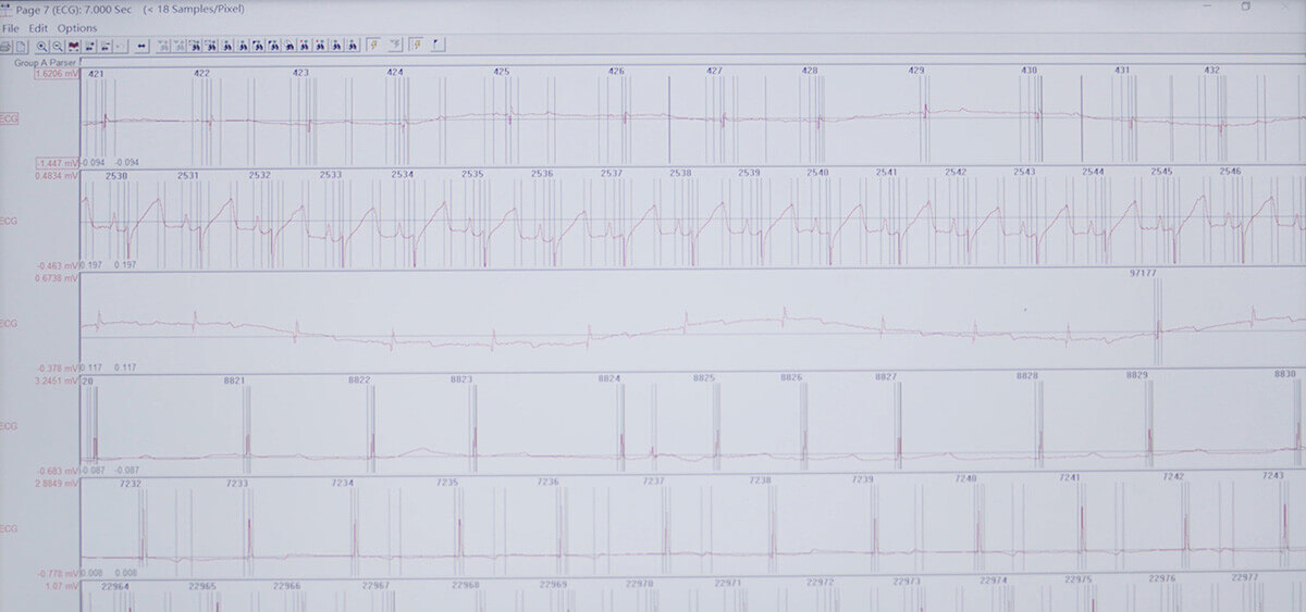 人生就是博官方网站 SEND 数据转换平台