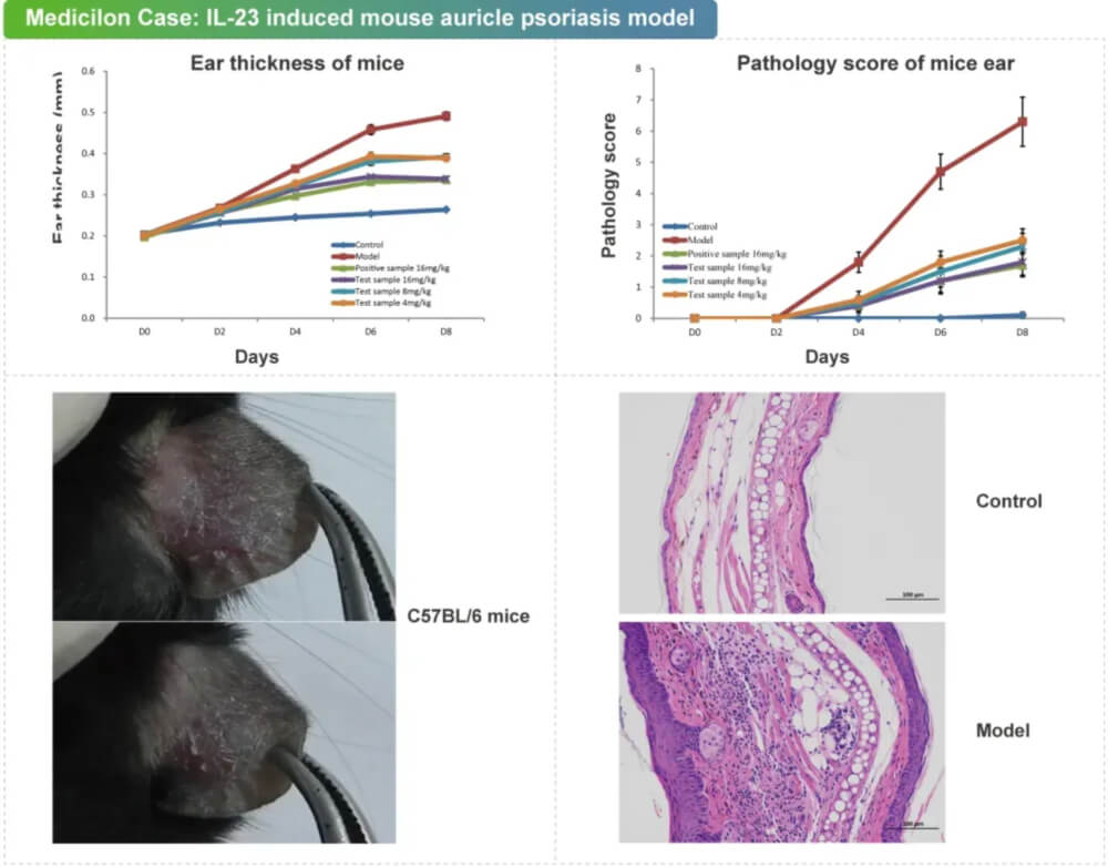 06 IL-23诱导的小鼠耳廓银屑病模子.jpg