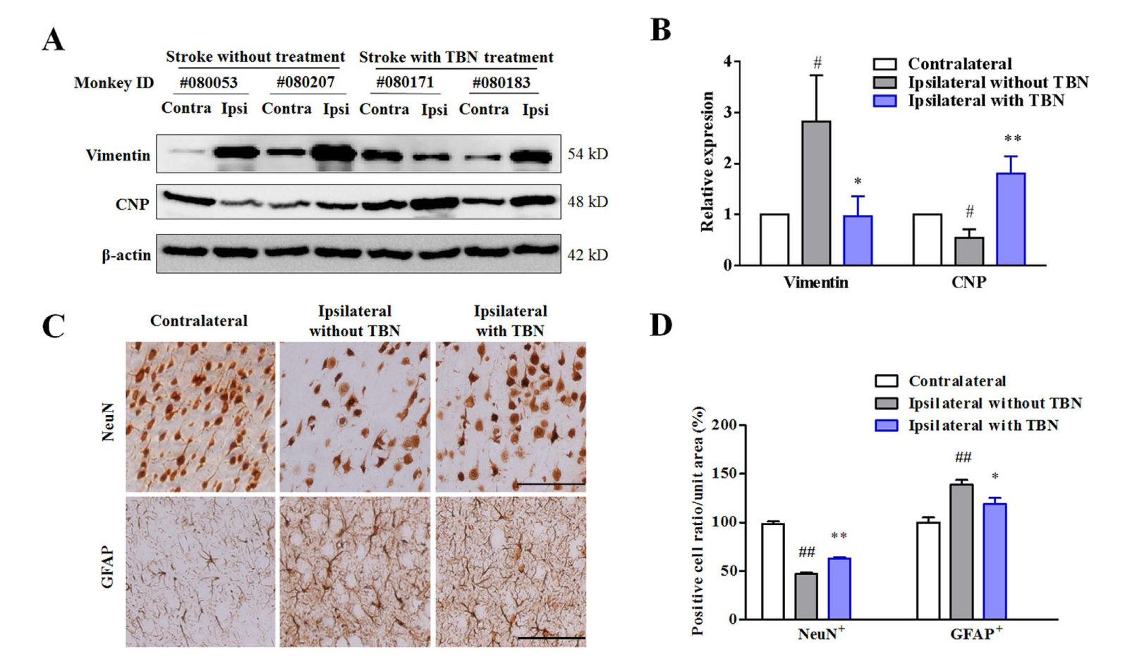 TBN是一种治疗缺血性卒中的新型临床候选药物，，，本研究中TBN通过人生就是博官方网站合成